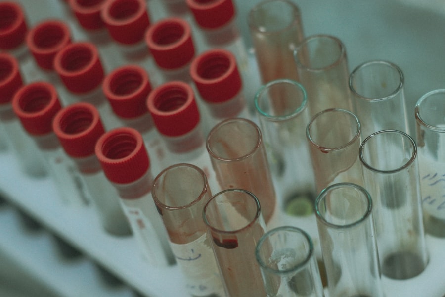 Liver Function Test (LFT)